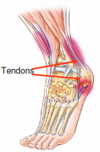 Disposition des tendons - Labrha